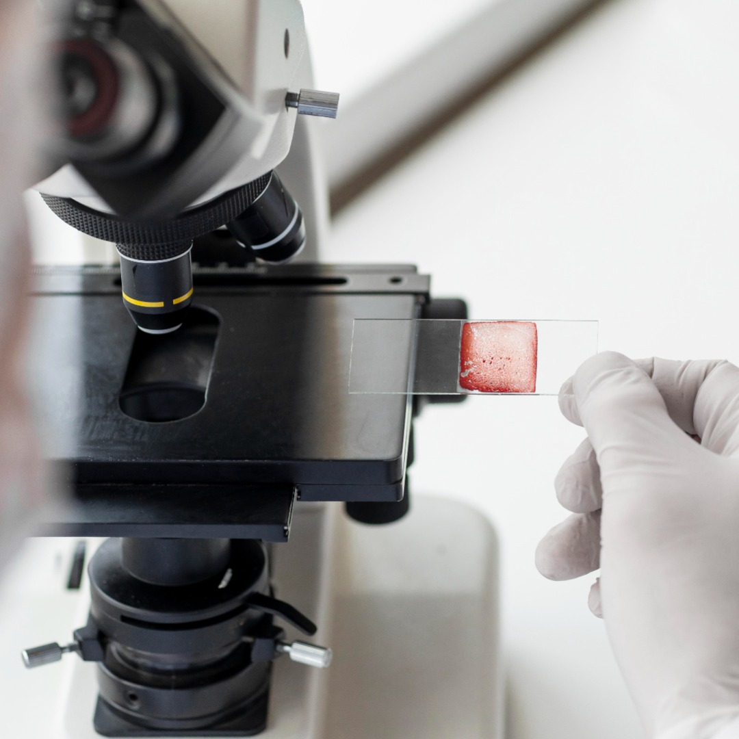 Conheça a importância do diagnóstico histopatológico